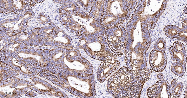 MTCO2 Antibody in Immunohistochemistry (Paraffin) (IHC (P))