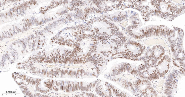 TCF7L2 Antibody in Immunohistochemistry (Paraffin) (IHC (P))