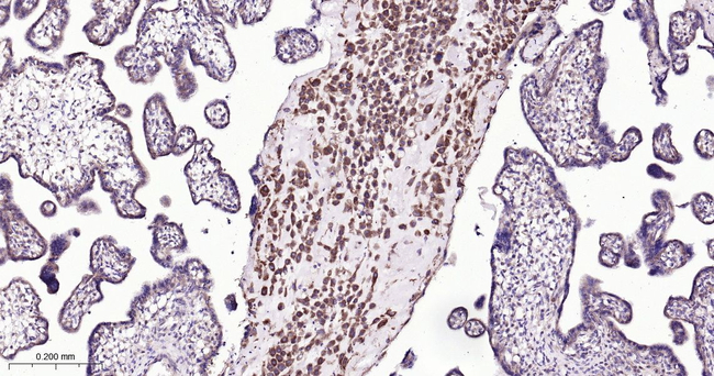 ATG5 Antibody in Immunohistochemistry (Paraffin) (IHC (P))
