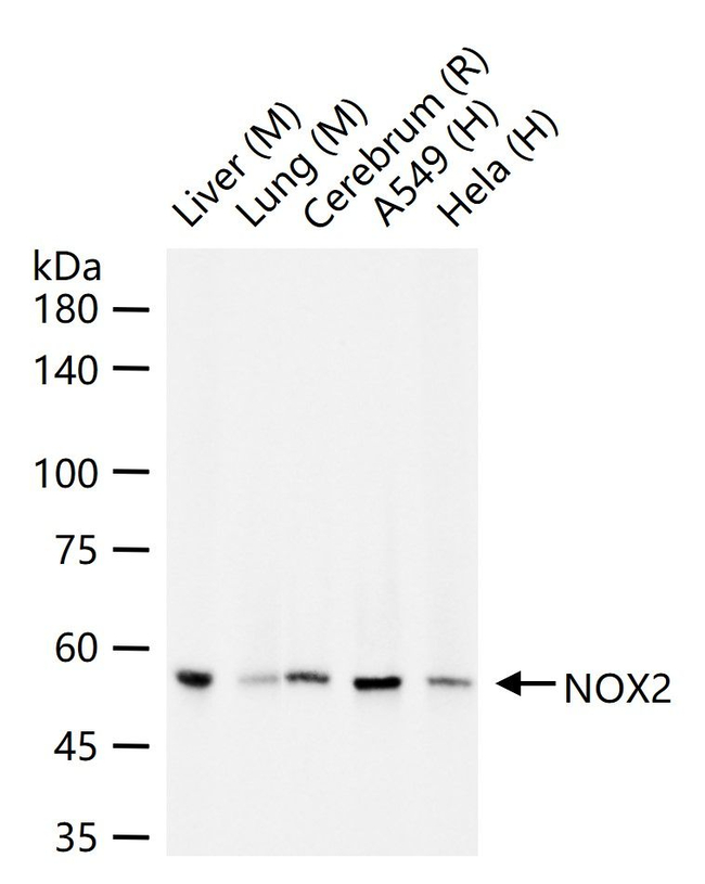 NOX2 Antibody in Western Blot (WB)