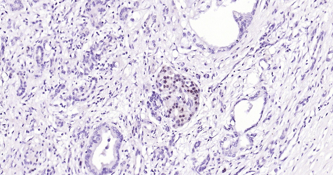 PAX6 Antibody in Immunohistochemistry (Paraffin) (IHC (P))