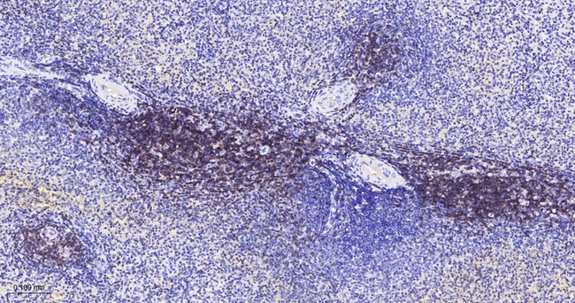 CD3d Antibody in Immunohistochemistry (Paraffin) (IHC (P))