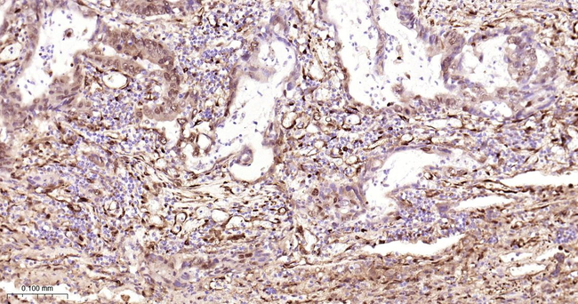 HSP27 Antibody in Immunohistochemistry (Paraffin) (IHC (P))