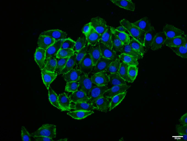 CCR7 Antibody in Immunocytochemistry (ICC/IF)