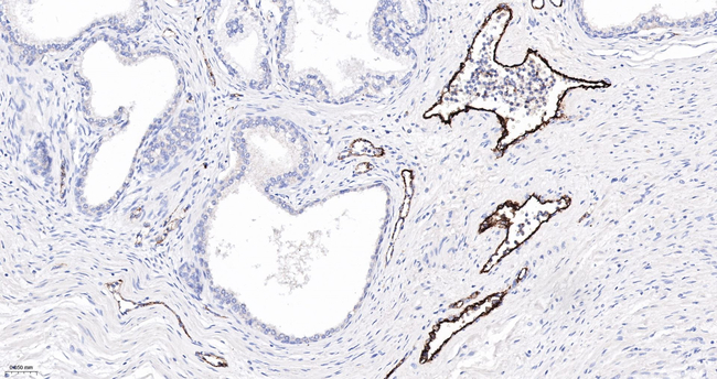 VWF Antibody in Immunohistochemistry (Paraffin) (IHC (P))