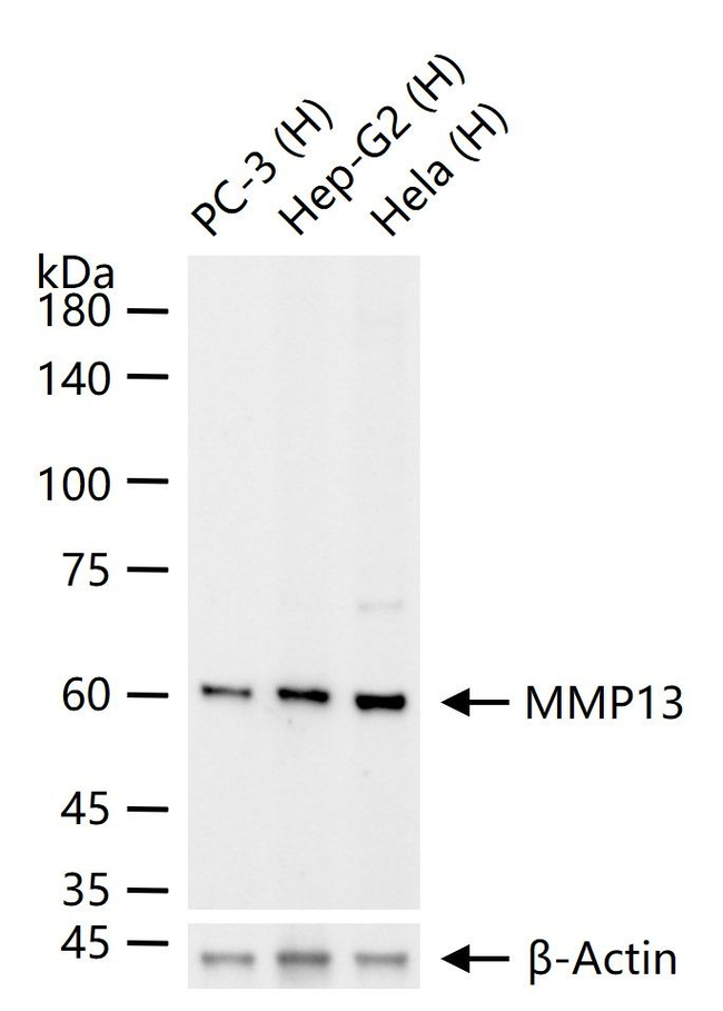 MMP13 Antibody in Western Blot (WB)