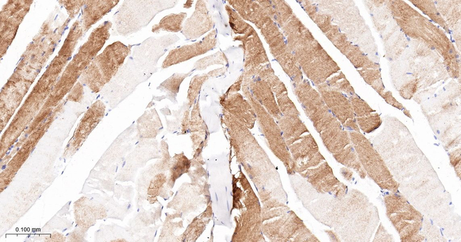 alpha Actinin 2 Antibody in Immunohistochemistry (Paraffin) (IHC (P))