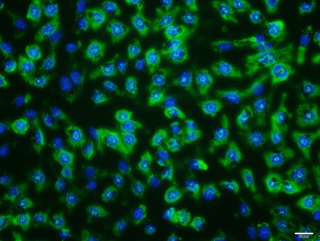CD56 Antibody in Immunocytochemistry (ICC/IF)