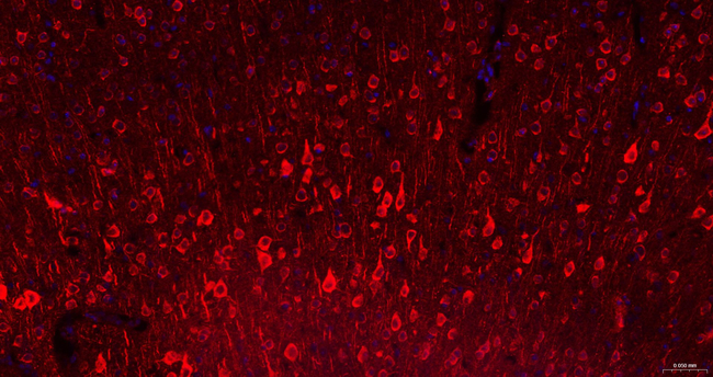 NF-H Antibody in Immunohistochemistry (Paraffin) (IHC (P))