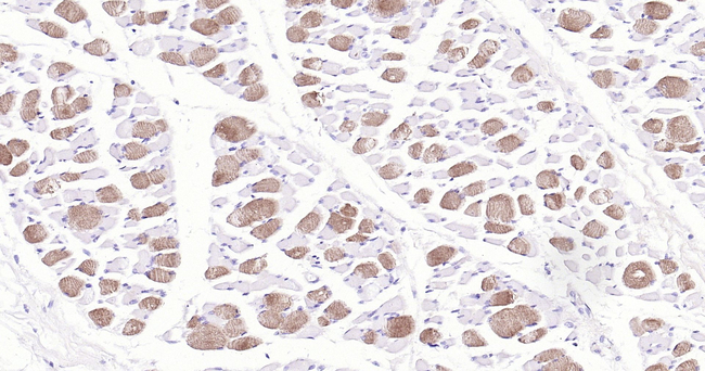 MYH6 Antibody in Immunohistochemistry (Paraffin) (IHC (P))