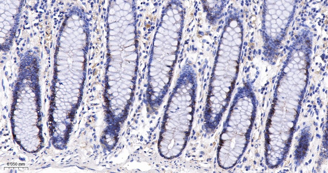 beta-2 Adrenergic Receptor Antibody in Immunohistochemistry (Paraffin) (IHC (P))