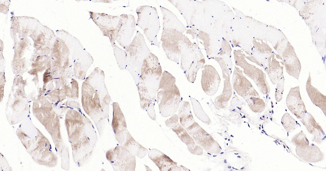 CHOP Antibody in Immunohistochemistry (Paraffin) (IHC (P))