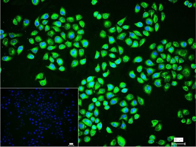 ATP Synthase beta Antibody in Immunocytochemistry (ICC/IF)