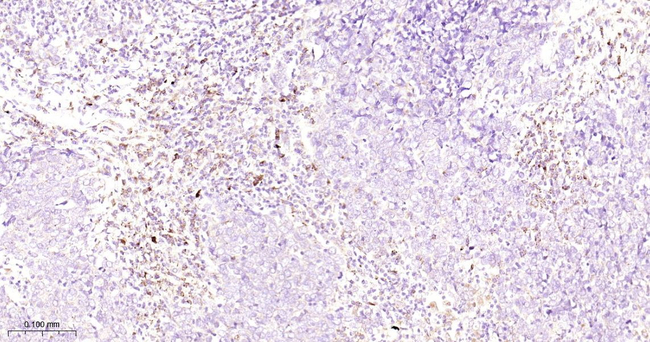 GBA Antibody in Immunohistochemistry (Paraffin) (IHC (P))