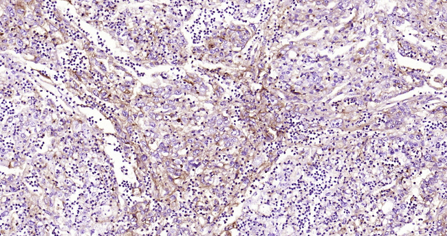 CD73 Antibody in Immunohistochemistry (Paraffin) (IHC (P))