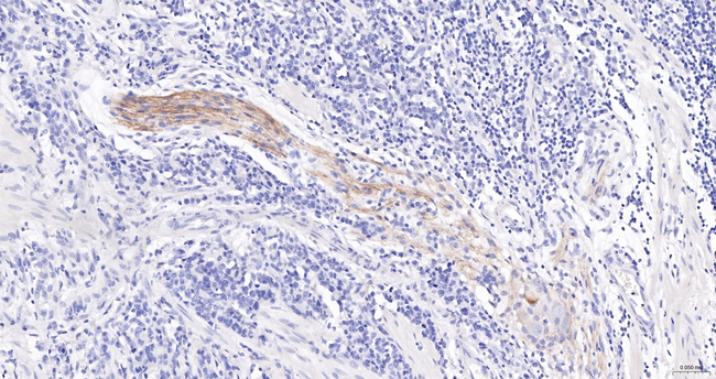 CD171 Antibody in Immunohistochemistry (Paraffin) (IHC (P))