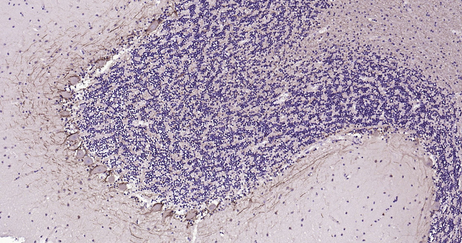 NF-M Antibody in Immunohistochemistry (Paraffin) (IHC (P))