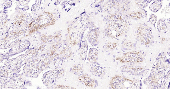Podoplanin Antibody in Immunohistochemistry (Paraffin) (IHC (P))