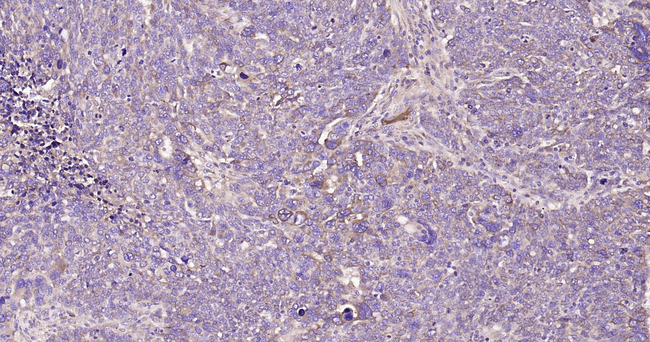 A2M Antibody in Immunohistochemistry (Paraffin) (IHC (P))