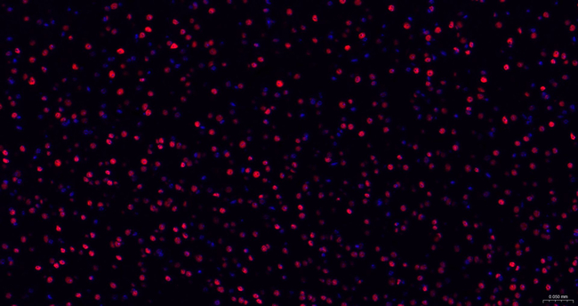 TDP-43 Antibody in Immunohistochemistry (Paraffin) (IHC (P))