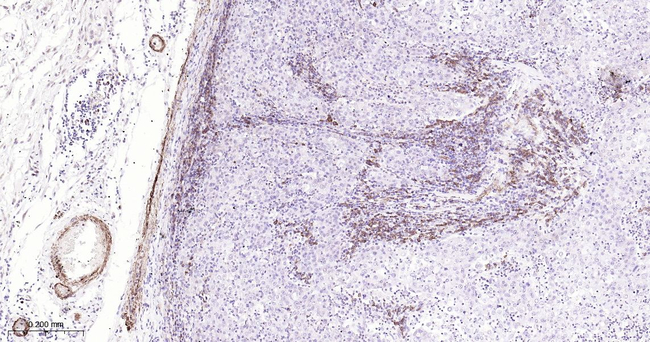 MYH11 Antibody in Immunohistochemistry (Paraffin) (IHC (P))
