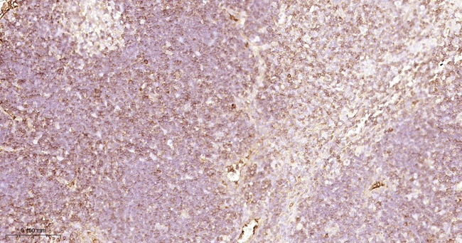 CD3 Antibody in Immunohistochemistry (Paraffin) (IHC (P))