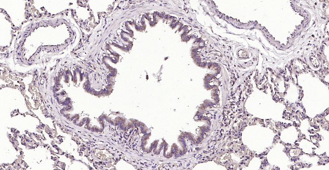 CD39 Antibody in Immunohistochemistry (Paraffin) (IHC (P))