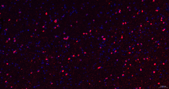 NMDAR2A Antibody in Immunohistochemistry (Paraffin) (IHC (P))