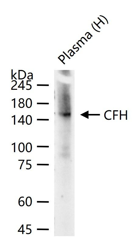 Complement Factor H Antibody in Western Blot (WB)