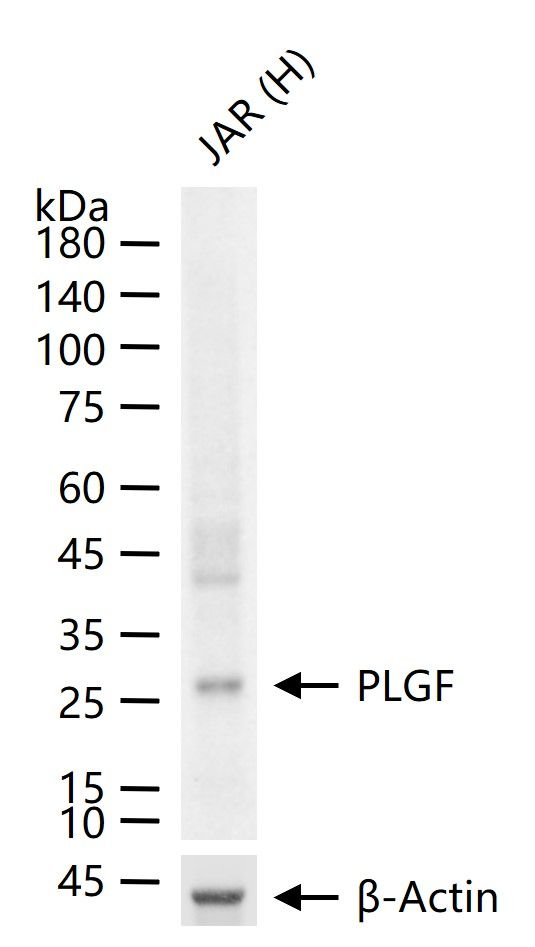PGF Antibody in Western Blot (WB)