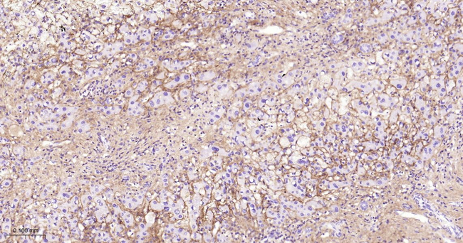 TGFBI Antibody in Immunohistochemistry (Paraffin) (IHC (P))