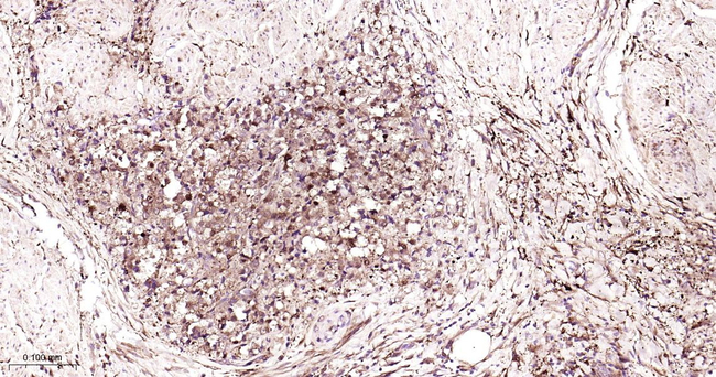 Ferritin Heavy Chain Antibody in Immunohistochemistry (Paraffin) (IHC (P))