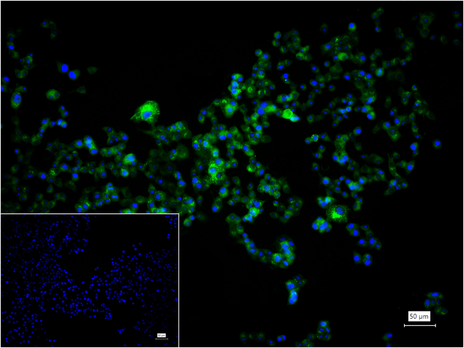 TXNIP Antibody in Immunocytochemistry (ICC/IF)