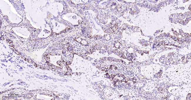 JAK1 Antibody in Immunohistochemistry (Paraffin) (IHC (P))