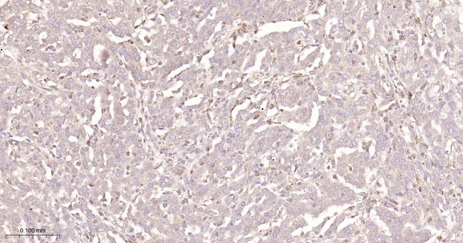 TFF1 Antibody in Immunohistochemistry (Paraffin) (IHC (P))