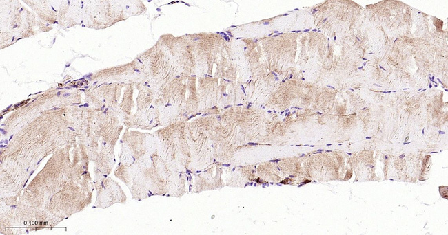 GCLM Antibody in Immunohistochemistry (Paraffin) (IHC (P))