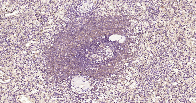 TLR2 Antibody in Immunohistochemistry (Paraffin) (IHC (P))