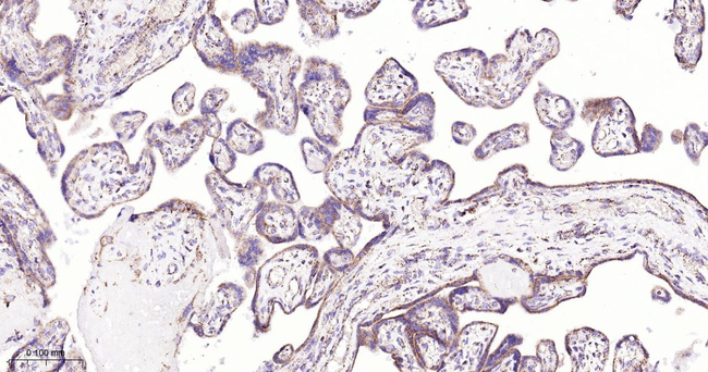 MMP3 Antibody in Immunohistochemistry (Paraffin) (IHC (P))