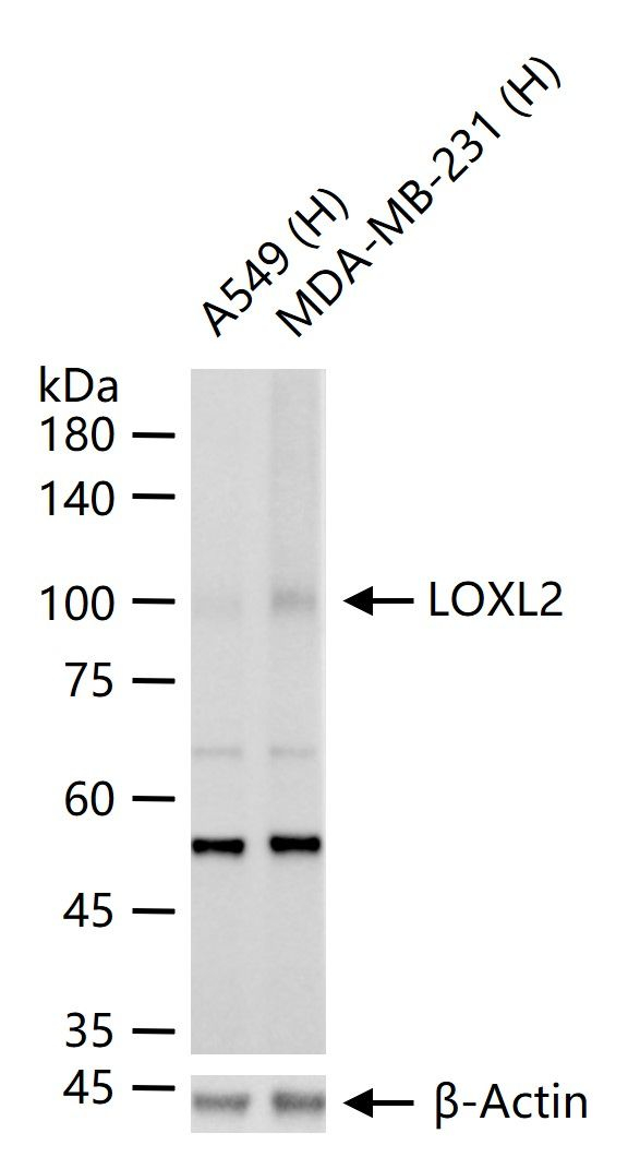 LOXL2 Antibody in Western Blot (WB)