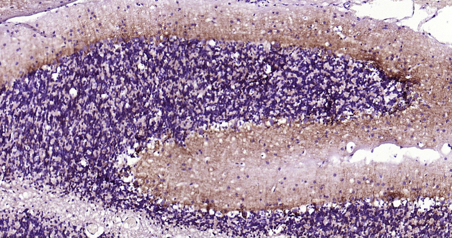 alpha Internexin Antibody in Immunohistochemistry (Paraffin) (IHC (P))