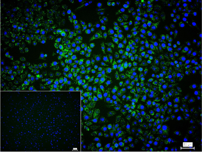 SDHB Antibody in Immunocytochemistry (ICC/IF)