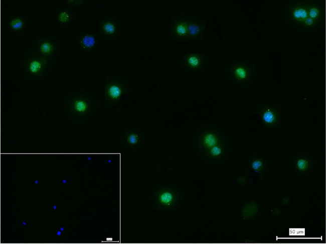 HDAC9 Antibody in Immunocytochemistry (ICC/IF)