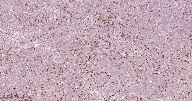 Zap-70 Antibody in Immunohistochemistry (Paraffin) (IHC (P))