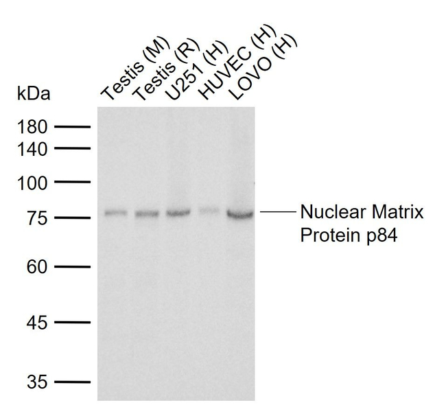 Nuclear Matrix Protein p84 Antibody in Western Blot (WB)