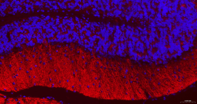 GABBR2 Antibody in Immunohistochemistry (Paraffin) (IHC (P))