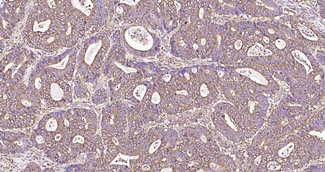 RPS19 Antibody in Immunohistochemistry (Paraffin) (IHC (P))