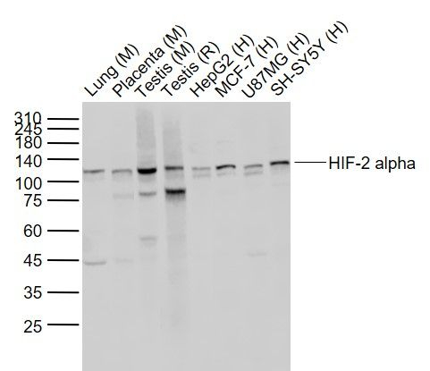 HIF-2 alpha Antibody in Western Blot (WB)