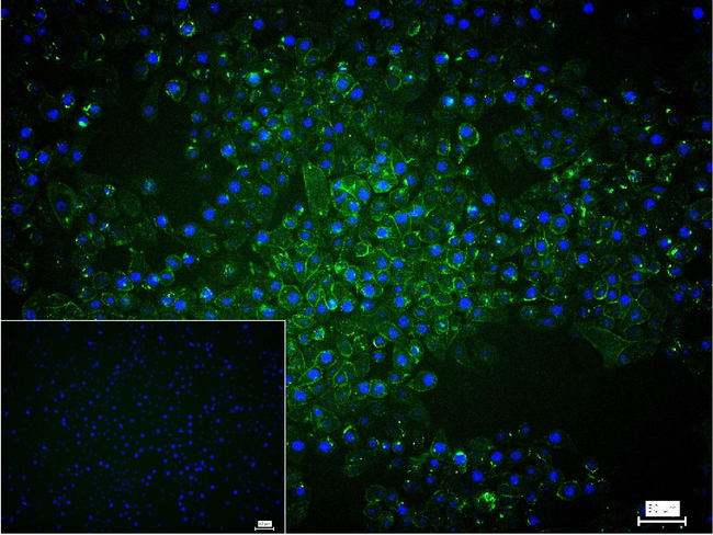 Desmoglein 2 Antibody in Immunocytochemistry (ICC/IF)