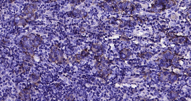 CD46 Antibody in Immunohistochemistry (Paraffin) (IHC (P))