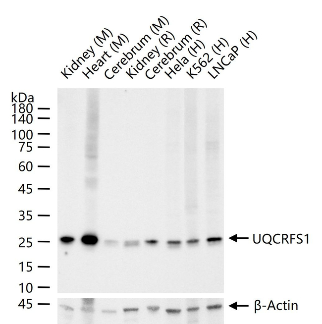 UQCRFS1 Antibody in Western Blot (WB)